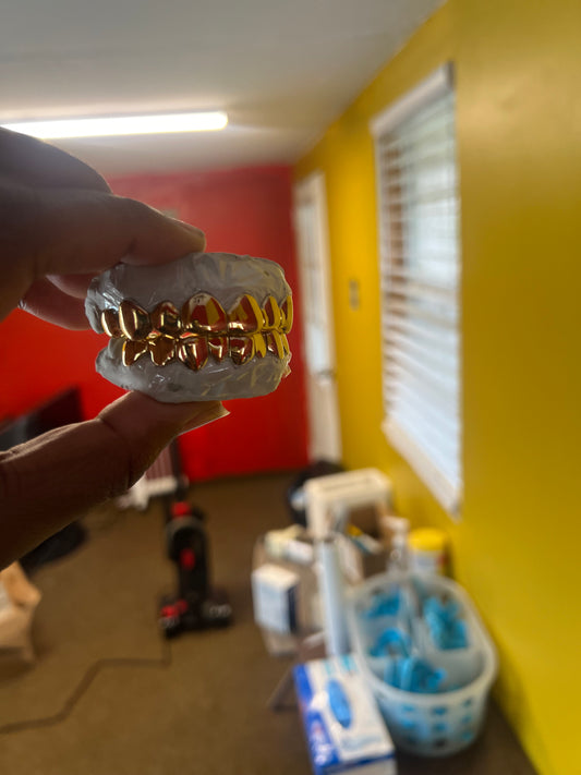 A gold-plated dental grill being held by a hand, with a blurred background.