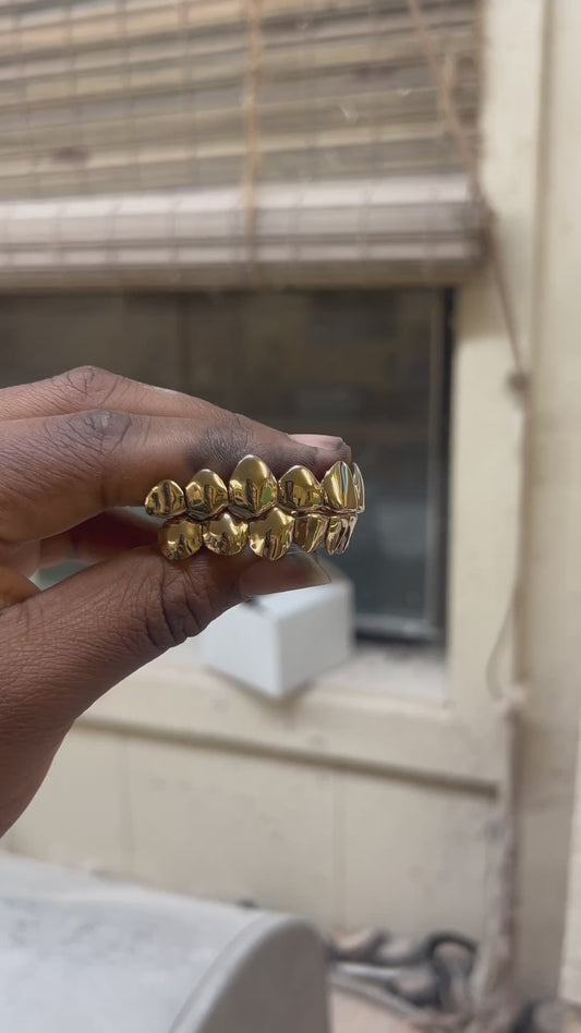 14K Gold Grillz